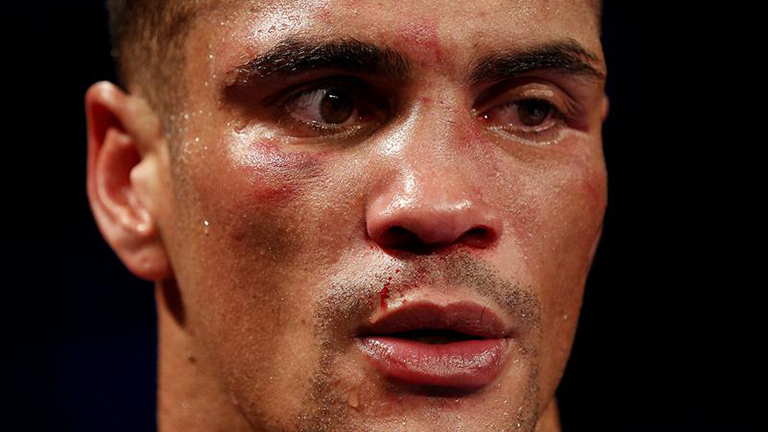 Boxing: The Incredible Sickness