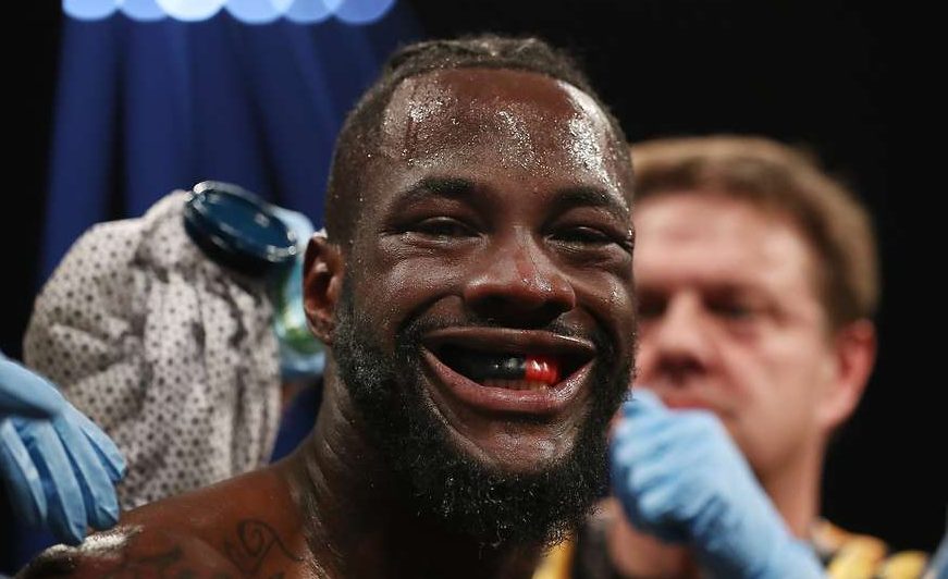 Deontay Wilder Unimpressed by Joshua-Miller at Madison Square Garden