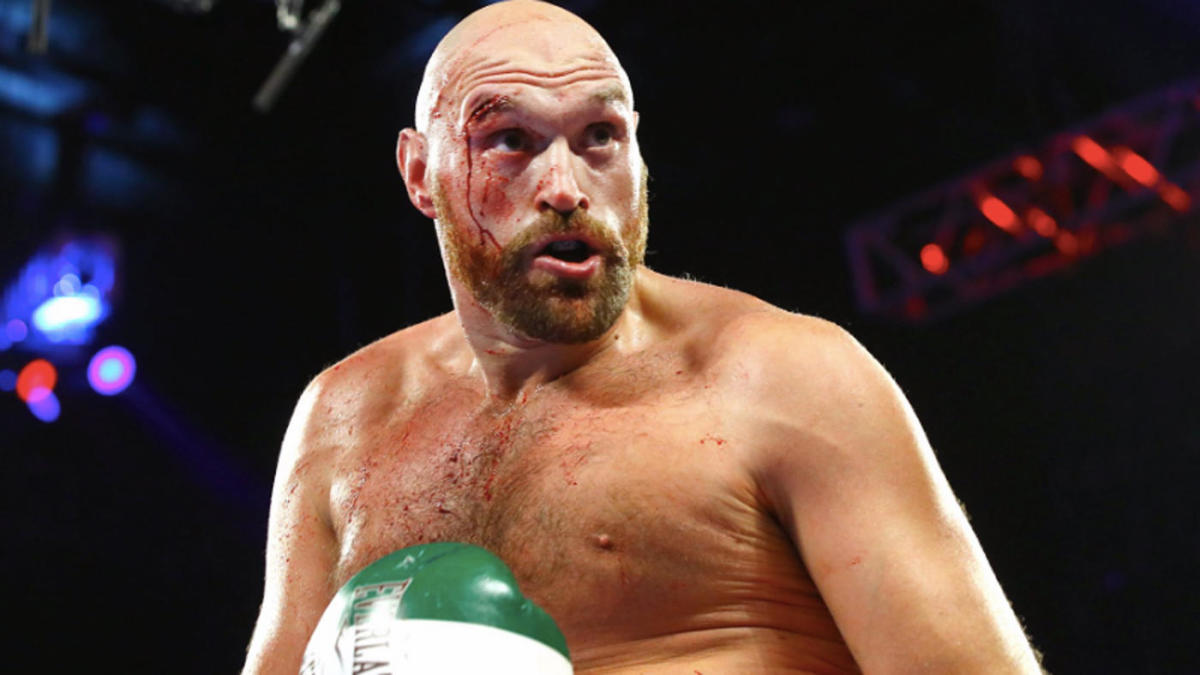 Jorge Capetillo reveals classy Tyson Fury gesture