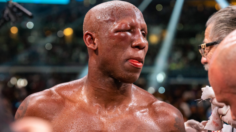 Ugas Suffers Broken Orbital Bone Following Loss To Spence Jr