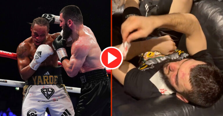 Yarde Shares Backstage Moment With Beterbiev As Both Receive Treatment