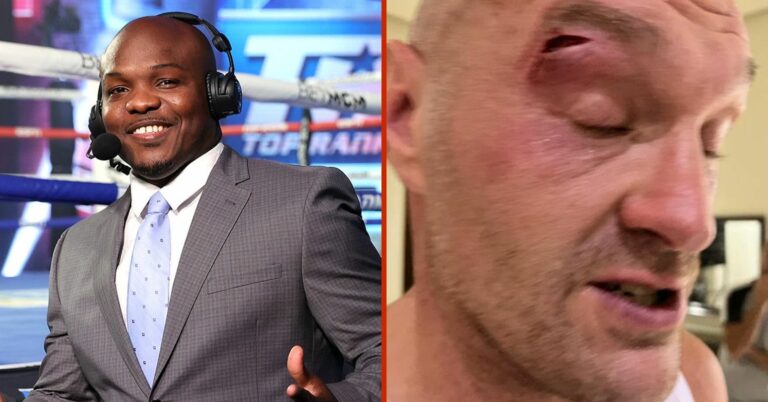 Tim Bradley Says ‘Karma’s A B**ch’ In Regards To Fury Sparring Cut