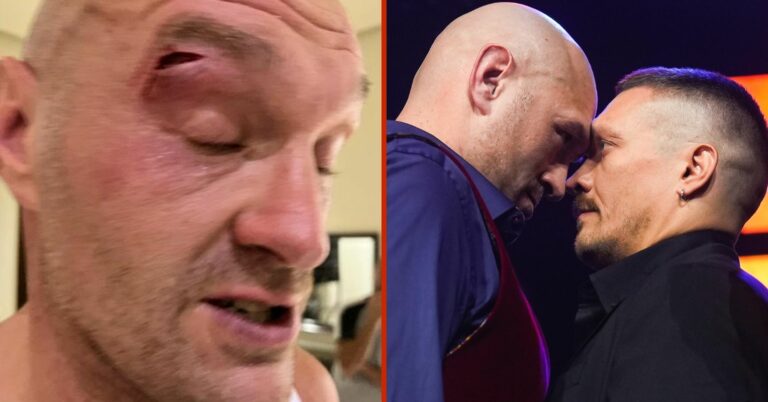 Tyson Fury Breaks Silence And Shows Off Horror Cut That Forced Usyk Undisputed Fight Off