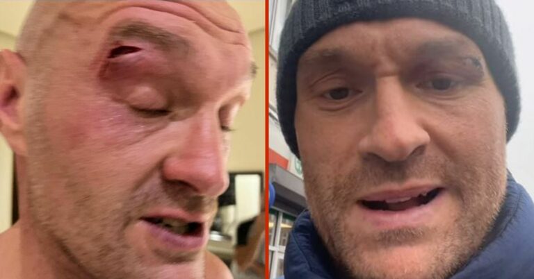 Top Trainer Says Fury Cut Is ‘A Blessing In Disguise’