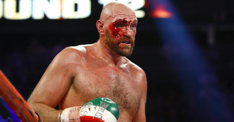 Fighter Who Previously Gave Tyson Fury 47 Stitches Reacts To Gypsy King’s New Cut