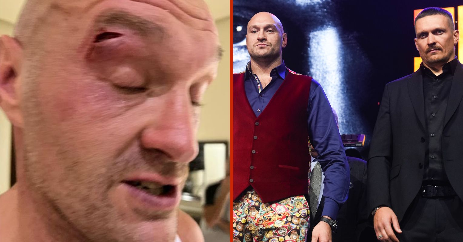 Fans React As Tyson Fury PULLS OUT Of Undisputed Title Clash Against Usyk