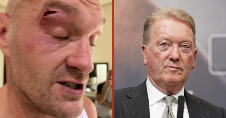Frank Warren Speaks On Tyson Fury’s Cut And What Must Happen Before Usyk Fight Is Rescheduled